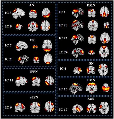 Increased functional connectivity between default mode network and visual network potentially correlates with duration of residual dizziness in patients with benign paroxysmal positional vertigo